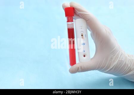 Il medico ha tenuto il test espresso per HCV e la provetta con il campione di sangue su sfondo colorato Foto Stock