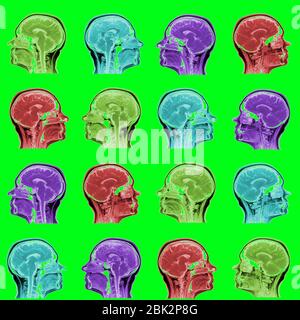 Schema continuo di scansioni MRI di sessanta anni caucasici testa femmina nel piano sagittale o longitudinale - teste colorate su sfondo verde acido Foto Stock