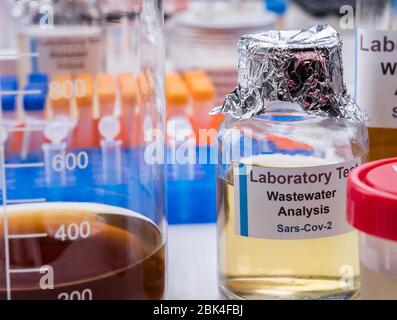 Campioni di acque reflue, analisi del virus sars-cov-2 in pazienti infettati da coronavirus umano 229E, immagine concettuale Foto Stock