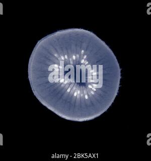 Kiwi slice, raggi X. Foto Stock