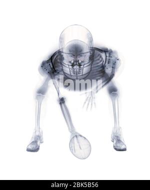 Giocatore di football americano scheletro, raggi X. Foto Stock