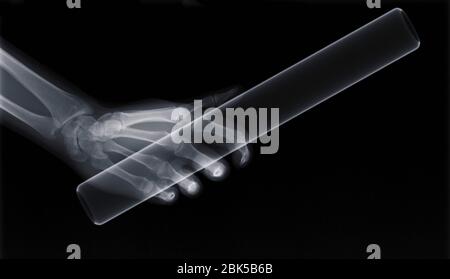 Bacchetta di tenuta a mano umana, raggi X. Foto Stock