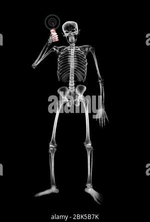Telefono cellulare con risposta scheletrica umana, raggi X. Foto Stock