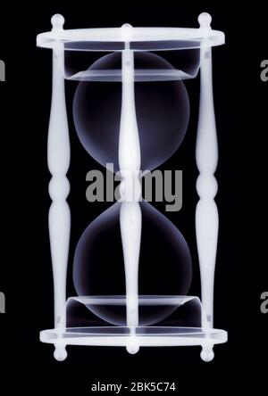 Clessidra, raggi X. Foto Stock