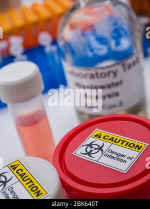 Analisi scientifica del campione di acque reflue in laboratorio, indagine di possibile contaminazione da parte di Sars-Cov-2 nell'uomo, immagine concettuale Foto Stock