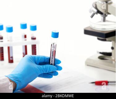 Microbiologo con una provetta di campione biologico contaminata da Coronavirus con etichetta Covid-19 Positive. Laboratorio con una provetta biologica per analisi Foto Stock