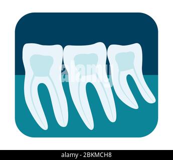 Raggi X dei denti umani. Tre molari sani a raggi X. Illustrazione vettoriale Illustrazione Vettoriale