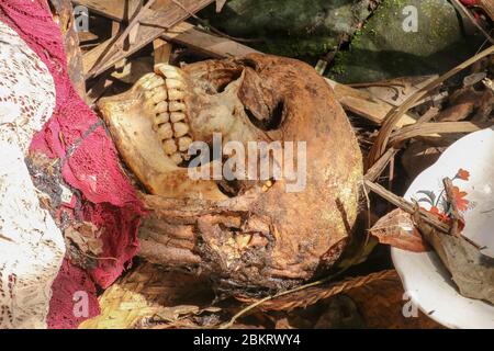 Vista ravvicinata del cranio umano di un uomo deceduto. Il cranio è ancora coperto di pelle con capelli e tessuti muscolari. Il cervello è visibile attraverso un foro nel Th Foto Stock