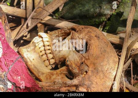 Vista ravvicinata del cranio umano di un uomo deceduto. Il cranio è ancora coperto di pelle con capelli e tessuti muscolari. Il cervello è visibile attraverso un foro nel Th Foto Stock