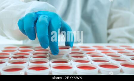 Mano ravvicinata del medico con guanto blu che solleva con le dita un contenitore bianco rotondo da un gruppo di campioni clinici rossi rotondi su una superficie bianca Foto Stock