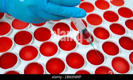 Primo piano della mano di un uomo con un guanto blu che regge un gergo, prelevando un campione di liquido rosso da un set di campioni clinici in contenitori rotondi su un bianco Foto Stock