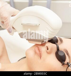 Dispositivo medico laser elos. Rimuovere i capelli e gli asterichi indesiderati. Cosmetologia Foto Stock