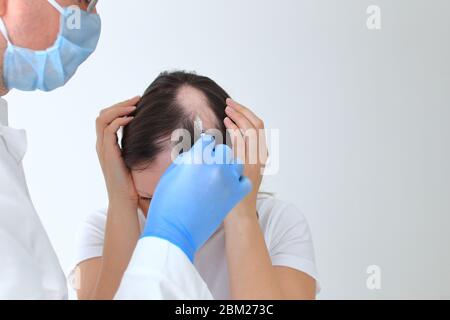 Le iniezioni nella testa calva di una ragazza. Vera alopecia areata Foto Stock