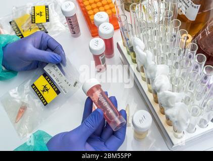 Lo scienziato esamina il campione di coronavirus in laboratorio, immagine concettuale Foto Stock