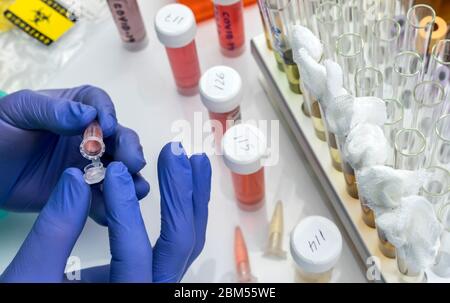 Lo scienziato esamina il campione di coronavirus in laboratorio, immagine concettuale Foto Stock