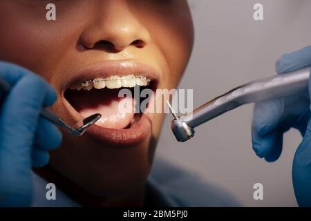 vista tagliata di ortodontista in guanti di lattice che tengono strumenti dentali vicino a donna afro-americana felice in bretelle Foto Stock