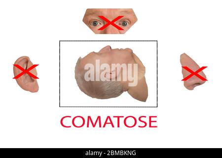 Vista laterale isolata testa umana in scatola trafilata con orecchio naso occhi fuori scatola su sfondo bianco. Concetti, comatoso, coma, inconscio Foto Stock