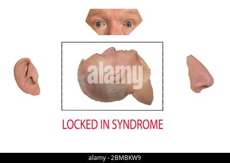Vista laterale isolata testa umana in scatola trafilata con orecchio naso occhi fuori scatola su sfondo bianco. Concetti bloccati in sindrome, comatosio, coma Foto Stock