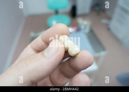 ponti dentali in ceramica metallica nelle mani di un medico Foto Stock