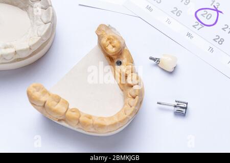 un impianto dentale con corona ceramica e strumento dentale giacciono su uno sfondo bianco, nel calendario in alto a destra, indicando una visita al dentista Foto Stock
