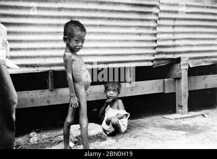 [ 1945 Giappone - WWII Internment Camp, Saipan ] - un ragazzo malato al WWII Susupe Internment Camp (ススッペキャンプ) a Saipan, ca. 1945 (Showa 20). Il campo fu aperto nel 1944 (Showa 19) per ospitare 13.000 civili giapponesi e 5.000 Chamorros, Kakanas e coreani. Fu chiuso il 4 luglio 1946 (Showa 21). La cattura statunitense delle Marianne Settentrionali nel luglio 1944 ha portato alla prima occupazione statunitense del territorio giapponese. stampa in argento gelatina del xx secolo. Foto Stock