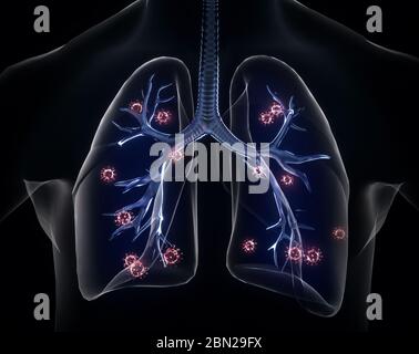 COVID-2019. Ologramma di coronavirus su sfondo nero. Tipo mortale di virus 2019-nCoV. Modelli 3D sistema respiratorio. Illustrazione 3D Foto Stock