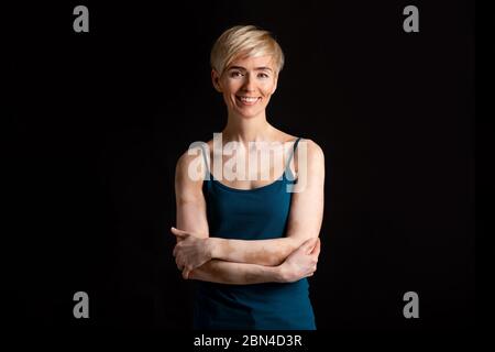 Amatevi. Cute donna positiva con vitiligo Foto Stock