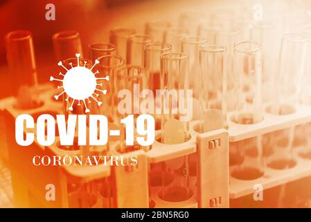 Microbiologo con una provetta di campione biologico contaminata da Coronavirus Covid-19 Foto Stock