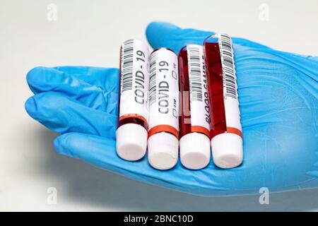 Fiale per campioni di sangue di pazienti sul palmo della mano di un medico esaminatore che indossa guanti in vista ravvicinata Foto Stock