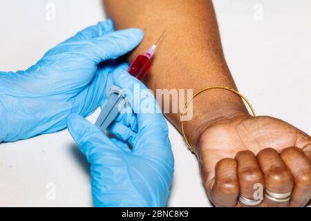 Mani di un medico che tiene una siringa per iniezione con il campione di sangue prelevato da una paziente indiana per il test del coronavirus Foto Stock
