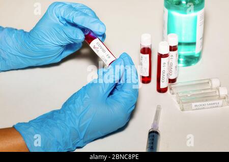 Mani di un infermiere che contiene un flaconcino di sangue positivo per il virus corona con siringa per iniezione e campioni di sangue di pazienti in un laboratorio di esame in India Foto Stock