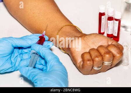 Mani di un medico che tiene una siringa per iniezione con il campione di sangue prelevato da una paziente indiana per il test del coronavirus Foto Stock