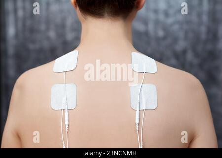 Terapia TENS nel trattamento della fibromialgia - elettrodi posti sulle spalle della paziente. Foto Stock