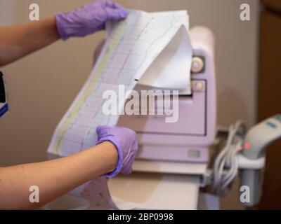 Un infermiere che controlla un grafico in un ospedale Foto Stock
