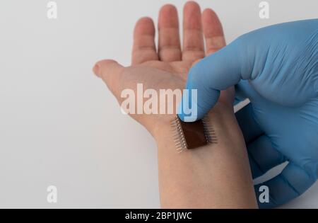 microchip è collegato ad una mano dell'uomo. impianto di un chip sotto la pelle umana. Foto Stock