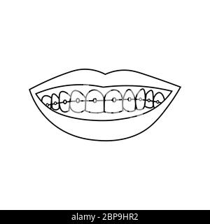 Labbra sorridenti con denti e bretelle. Contorno nero su sfondo bianco. L'illustrazione vettoriale può essere utilizzata in biglietti d'auguri, poster, volantini, banner, promozioni, inviti, ecc. EPS10 Illustrazione Vettoriale
