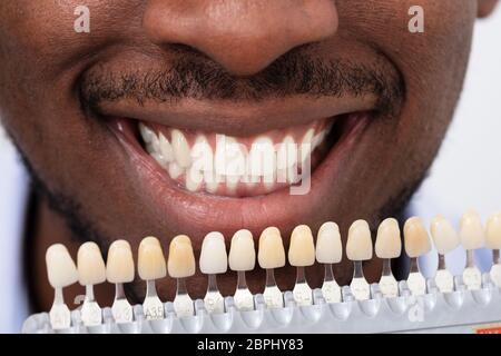 Close-up di un sorridente uomo africano tenendo insieme di impianti con varie sfumature di tono Foto Stock