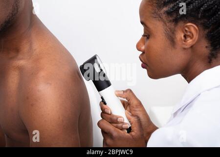 Close-up di una femmina di controllo medico di pigmento sulla pelle uomo torna con Dermatoscope Foto Stock