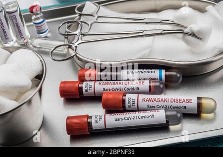 Campioni di sangue per il trattamento della malattia di Kawasaki correlata a Sars-COV-2 in bambini sotto i cinque anni, immagine concettuale Foto Stock