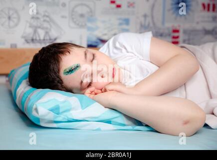 Un bambino con una lesione alla testa sta dormendo su un letto nella sua camera. Sicurezza Foto Stock