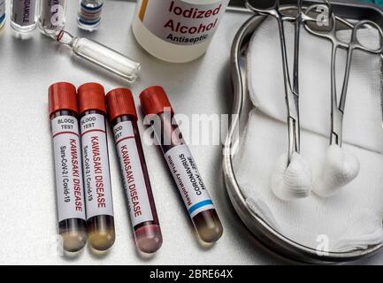 Campioni di sangue per il trattamento della malattia di Kawasaki correlata a Sars-COV-2 in bambini sotto i cinque anni, immagine concettuale Foto Stock