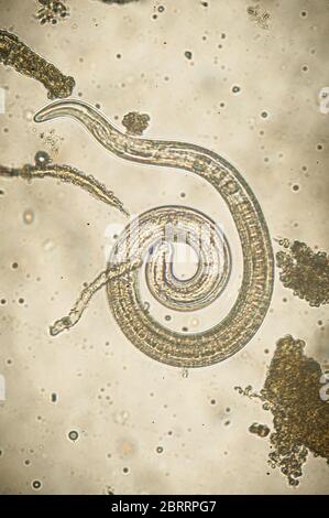 Trichinella spiralis - microscopio parassita nematoda worm Foto Stock