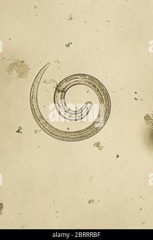 Trichinella spiralis - microscopio parassita nematoda worm Foto Stock