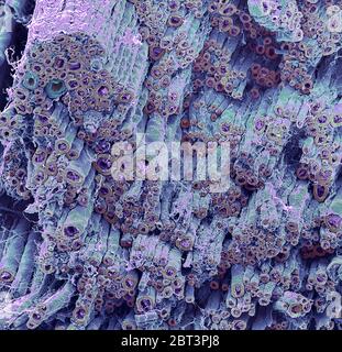 Nervo. Micrografia elettronica a scansione colorata (SEM) di una frattura congelata attraverso un nervo periferico. Le cellule di Schwann avvolgono la loro membrana cellulare intorno al nervo un certo numero di volte. Tra ciascuno strato di membrana cellulare è presente uno strato di mielina (marrone), uno strato grasso elettricamente isolante. Una cellula di Schwann addensa efficacemente la membrana di un nervo e aumenta la velocità con cui gli impulsi nervosi sono trasmessi. La mielina circonda gli assoni (viola). Il tessuto connettivo endoneurico (rosa) avvolge le fibre nervose. Ingrandimento: x150 se stampato a 10 centimetri di larghezza. Foto Stock