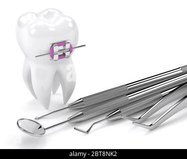 rendering 3d del dente con bretelle e strumenti diagnostici dentali su sfondo bianco Foto Stock