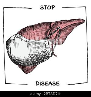 Fegato con maschera medica. Icona realistica disegnata a mano degli organi interni umani. Incisione art. Stile di schizzo. Progettazione per i progetti medici Illustrazione Vettoriale