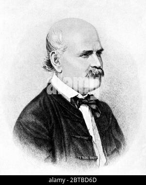 1860 , AUSTRIA : il medico e scienziato ungherese-austriaco IGNAZ PHILIPP SEMMELWEIS ( 1818 - 1865 ). Ora conosciuto come un pioniere delle PROCEDURE ANTISETTICHE . Proporre la pratica del lavaggio delle mani con soluzioni di calce clorurata nel 1847 per la battaglia sulla FEBBRE PUERPERALE . - chirurgo - medico - MEDICO - medicina - SCIENZA - SCIENZA - scienzito - SCIENZITO - MEDICO - MEDICINA - scienza - SCIENZA - scienza - scienzito - IIGIENE - LAVARE LE MANI - LAVAGGIO - VIRUS - VIROLOGIA - VIROLOGO - PROCEDURA ANTISETTICHE - SETTICEMIA ---- ARCHIVIO G Foto Stock