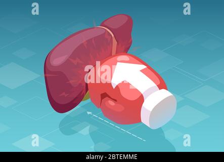 Vettore di un guanto di boxe che pugni un fegato umano. Concetto di dolore e malattia epatici Illustrazione Vettoriale