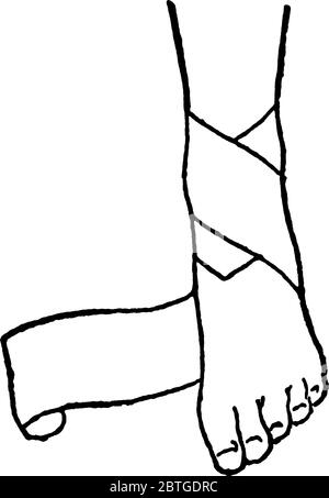 Una gamba avvolta in una fasciatura intorno alla caviglia, disegno di linea vintage o illustrazione di incisione. Illustrazione Vettoriale