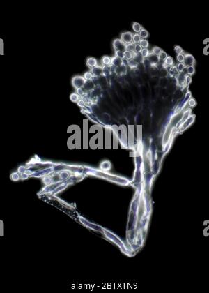 Stampo Penicillium al microscopio, campo scuro, obiettivo olio 100x Foto Stock